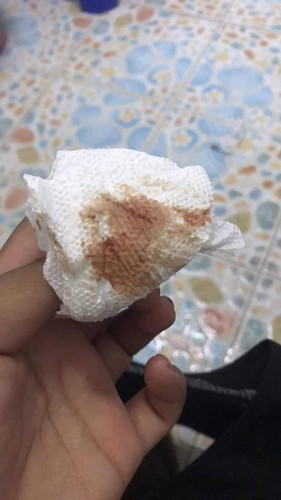 เลือดออกหลังคลอดได้2เดือน