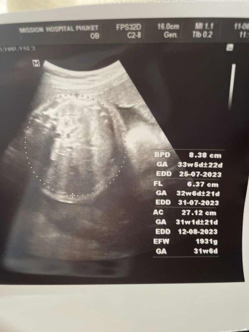 อัพเดทน้ำหนักลูกกันหน่อยค่า