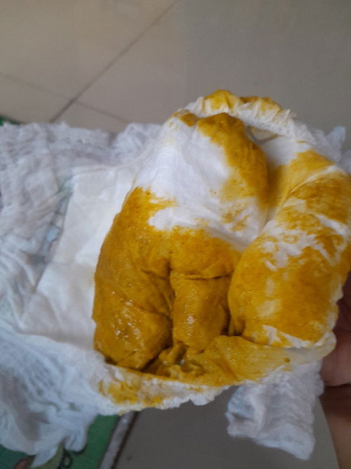 Masalah pup sufor mix ASI