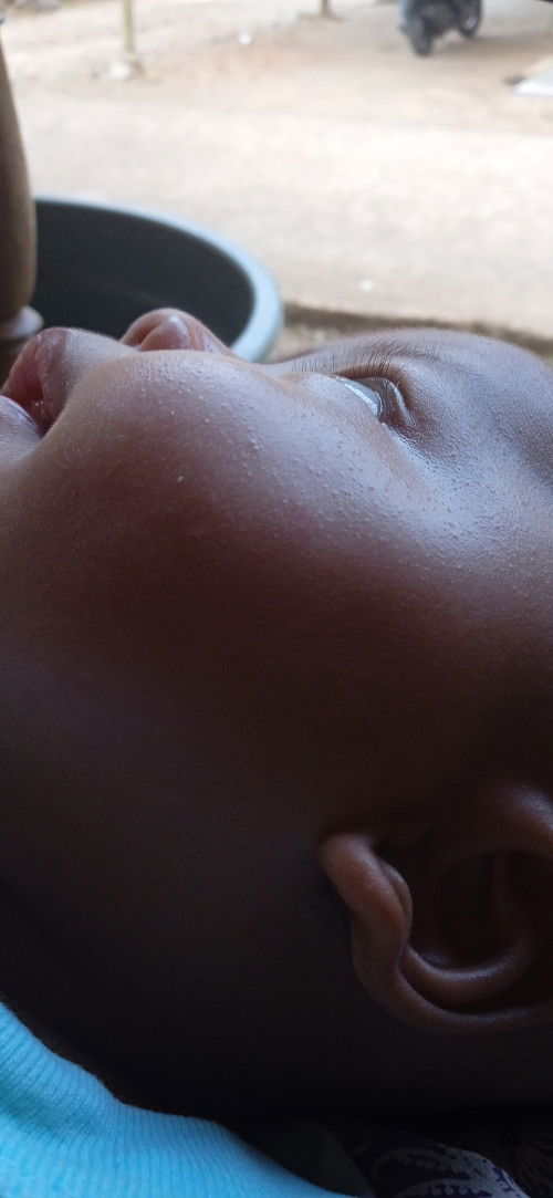 Muka bayi begitu bund.. Ngatasinnya dengan apa ya?