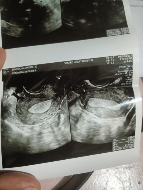 MAKAPAL LINING/FAINT LINE