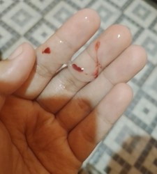 ada siapa pernah keluar macam ni?? (gambar google)