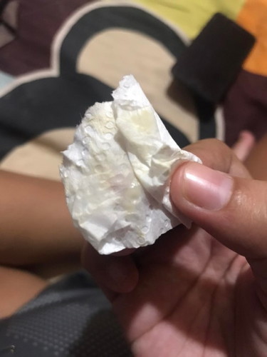 37+1 w มูกหรือตกขาวค่ะ