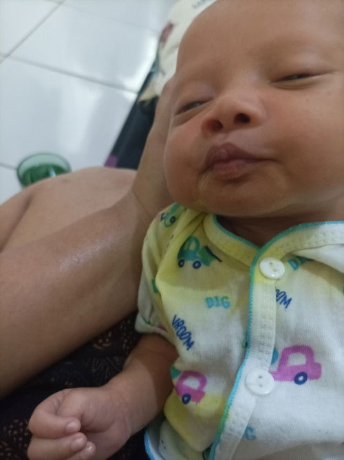 Gumoh berwana kuning