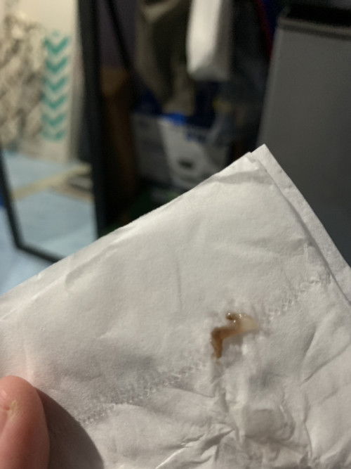 Telat Haid 4 Hari dan Kram perut disertai flek