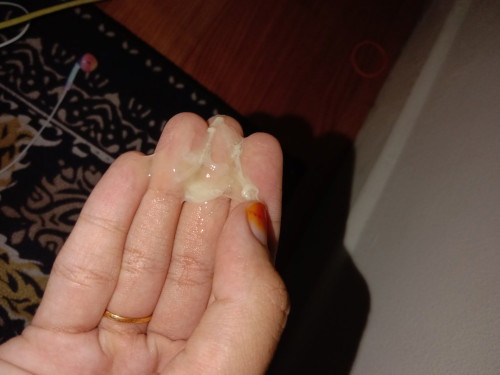 KEPUTIHAN NORMAL KE ATAU APE?
