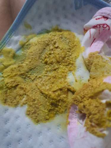Trẻ bú mẹ