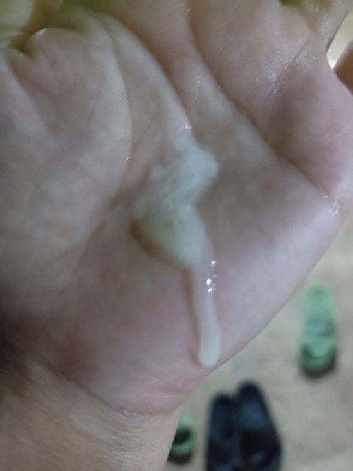 ตกขาวเเบบนี้ผิดปกติมั้ยค่ะ