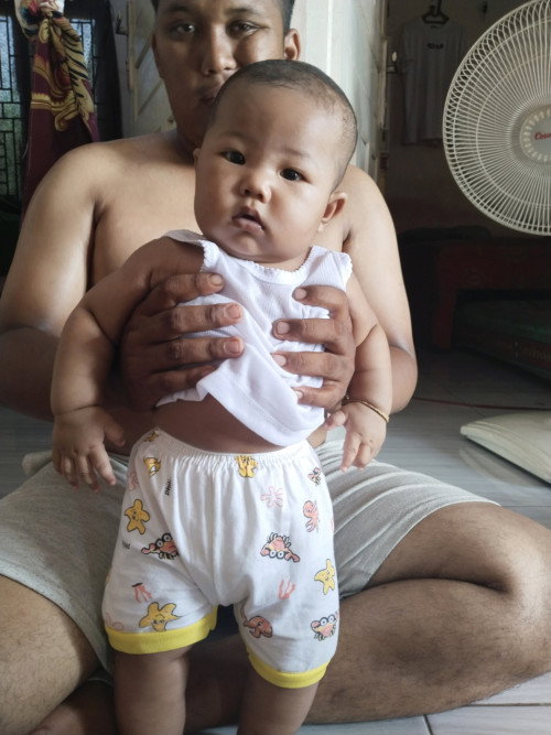 Apakah ini ciri tortikolis/ kepala miring pada bayi