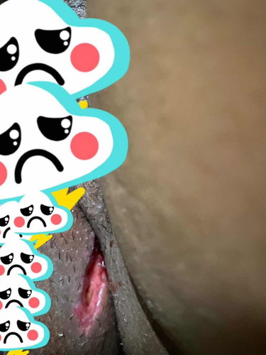 Bumuka tahi sa pwerta (11 days postpartum)