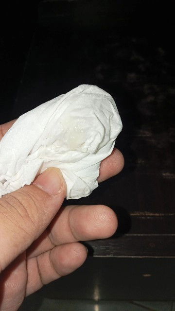 แบบนี้เรียกมูกใสหรือป่าวค่ะ