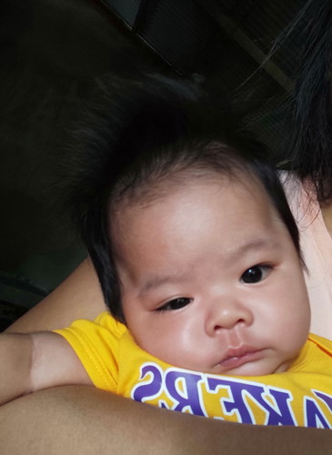 Bakit po kaya ganyan ulo ng LO ko sa may gilid po parang may palubog? Normal lang po kaya 2mos po sy