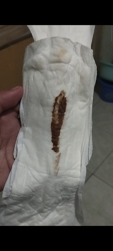 Normal ba na may lumabas na ganito sa Buntis ?ano Po ba ito?