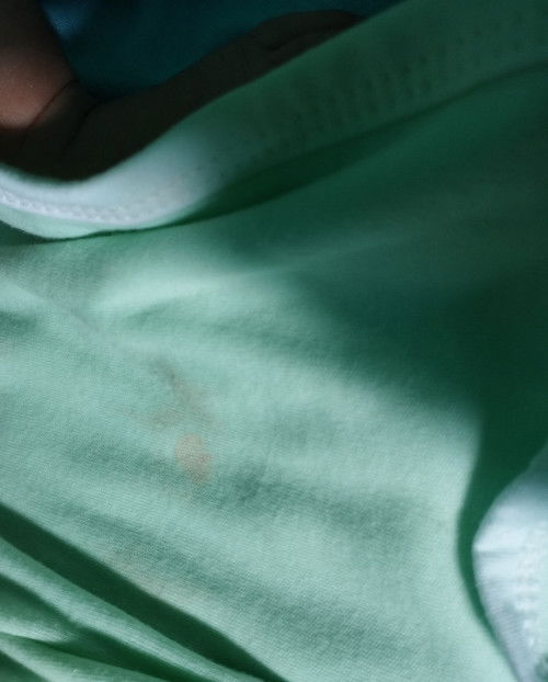 pipis ada bercak merah