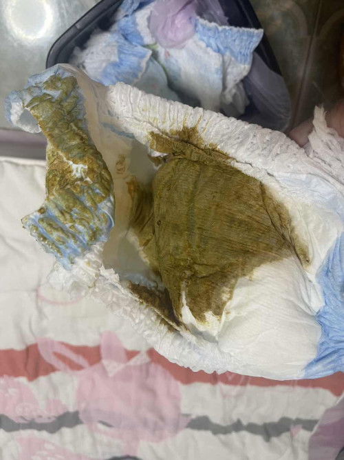 สอบถามค่ะ น้องกินนมผง