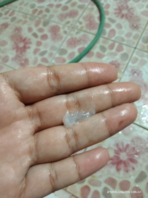 เจ็บท้องจี๊ดๆ