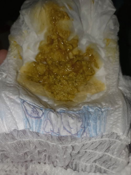 BAB pada bayi 6 bulan