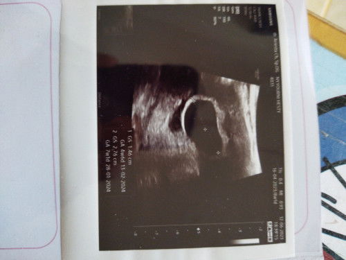 Mau tanya, tolong dijawab ya bun