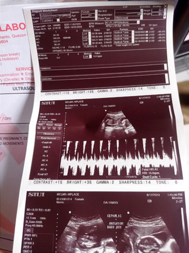 Ultrasound
