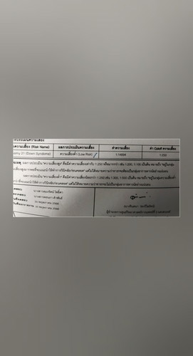 แม่ๆช่วยดูผลคัดกรองดาวน์
ซินโดรมให้หน่อยคะ ว่าผลแบบนี้ดีมั้ยคะ