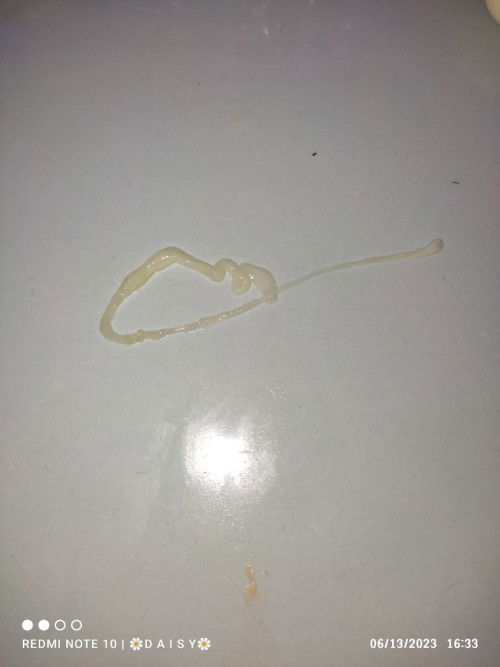 White Yeast Discharged