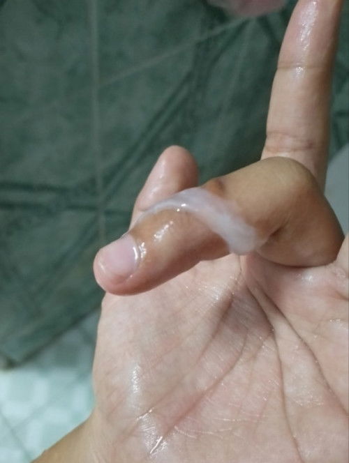 แบบนี้คือใกล้คลอดรึยังคะ