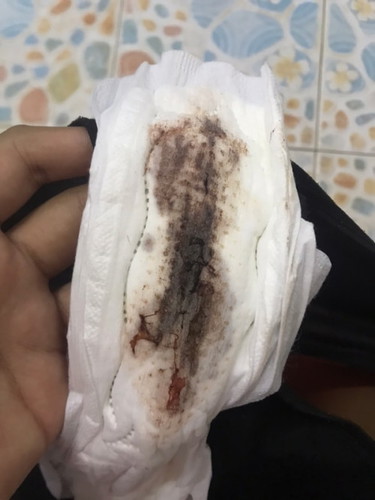 น้ำคาวปลาหรือประจำเดือน