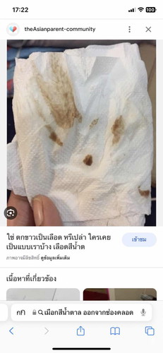 ไม่ได้ตรวจภายในหลังผ่าคลอด