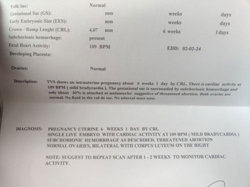 gestational sac is surrounded by subchorionic hemorrhage and only about 30% is attached at midanteri