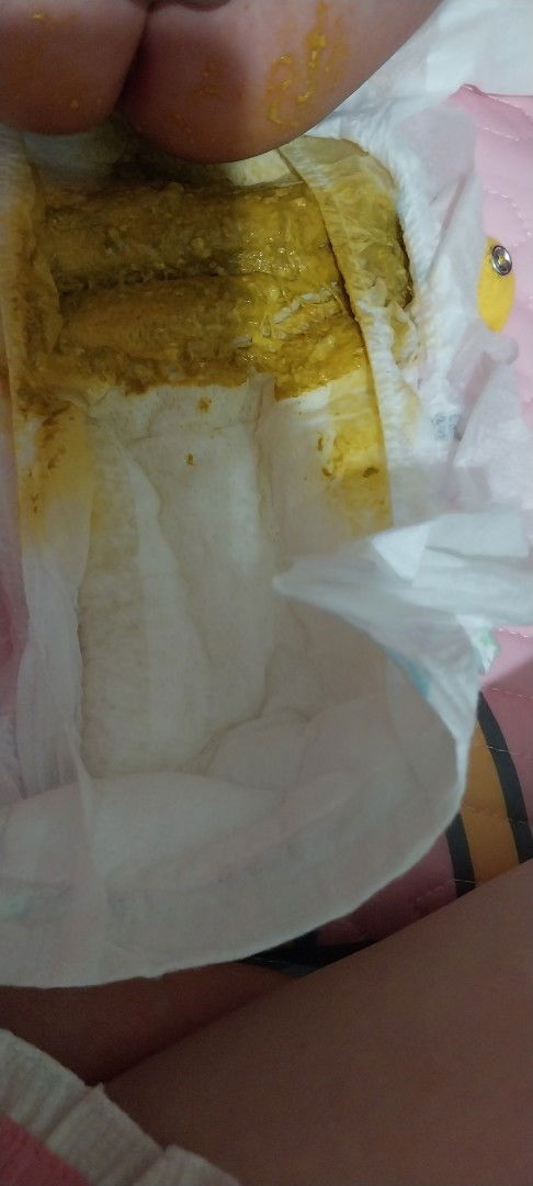 Phân của trẻ sơ sinh