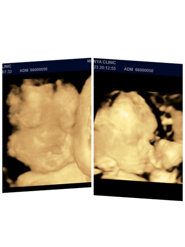 บ้านไหนมีลูกเเฝดบ้างค่ะ