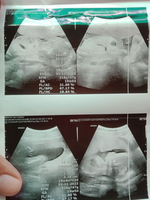 ขอความคิดเห็นของแม่ๆหน่อยค่ะ