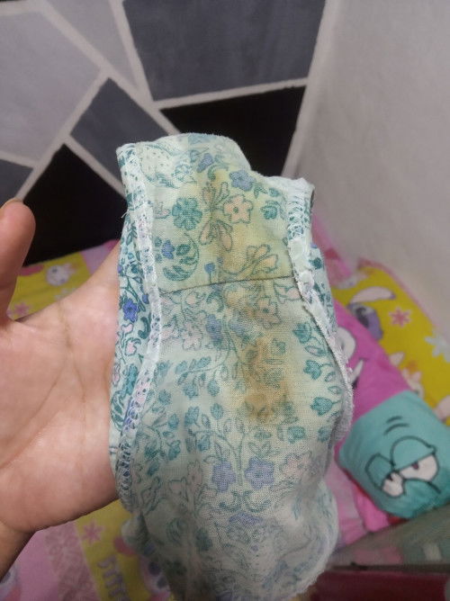 Normal ba o hindi?
Excuse po sa picture