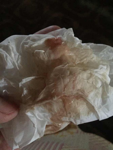 ใช่มูกเลือดไหมค่ะแม่