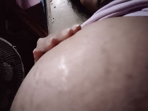 Anong gamot po sa stretch marks 29 weeks ako at first baby ko po pero Dami ko na po marks...help po