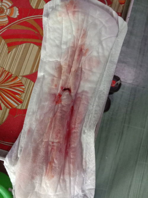 Blood discharge, no pain.