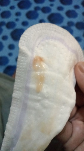 Mucus Plug