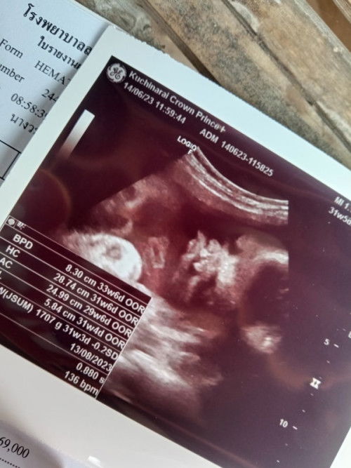 เเม่พอจะดูออกไหมค่ะ