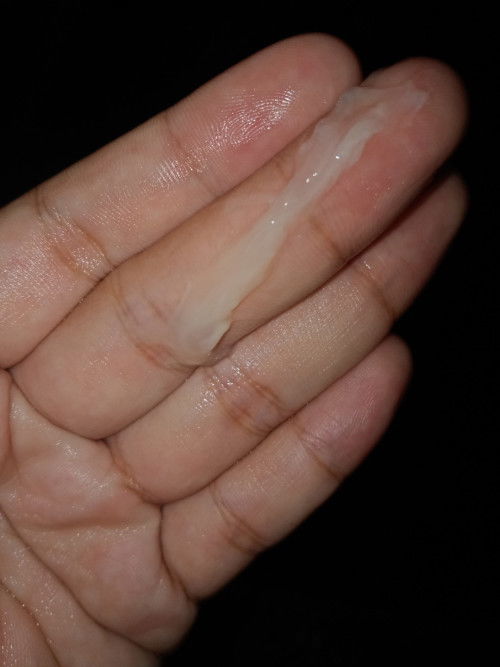 แบบนี้คือมูกหรือว่าตกขาวคะ