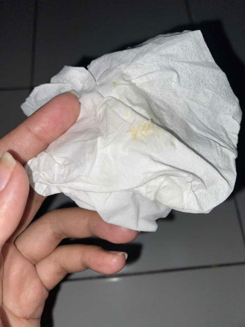 keputihan usia 13 weeks