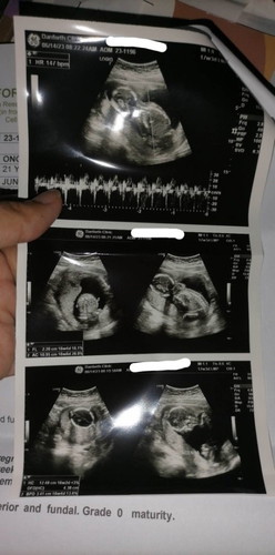 16 weeks and 4days