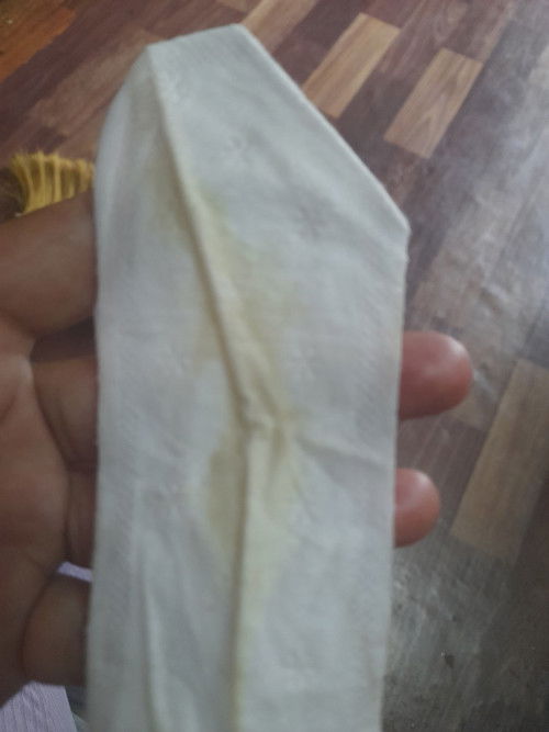 KELIRU ANTARA KEPUTIHAN ATAU AIR KETUBAN