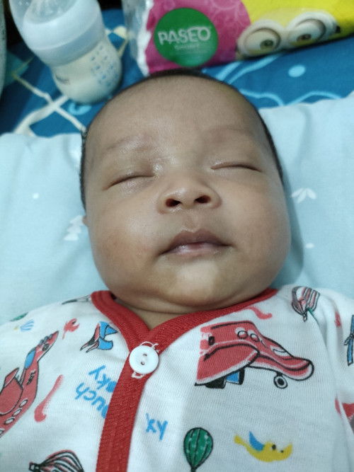 bercak putih pada muka