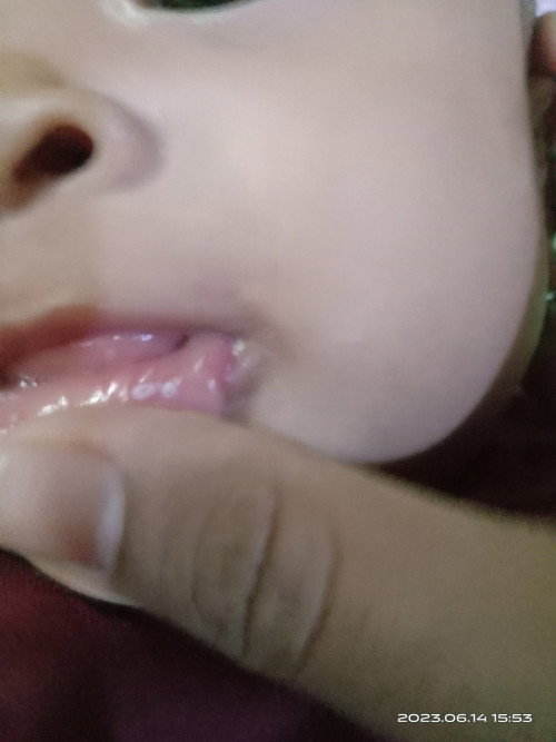 Mulut bayi