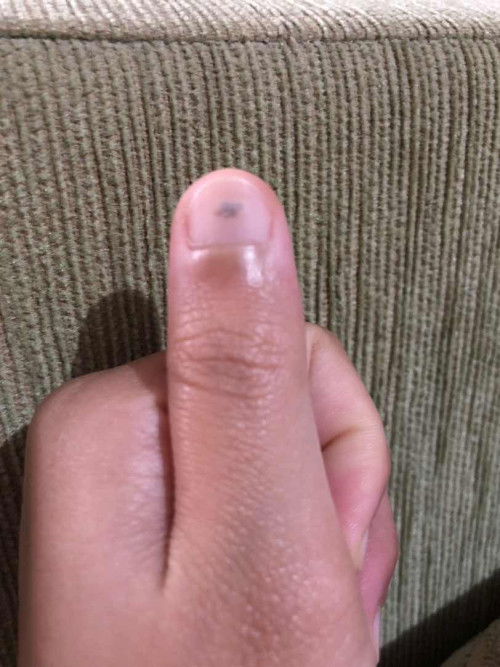 Bunda2,ada yg lg hamil ngalamin kyk gini?