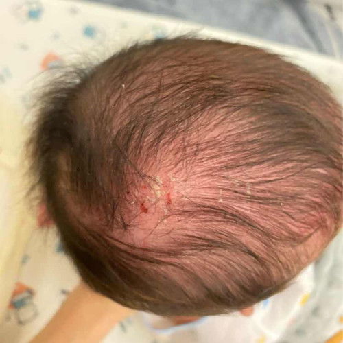 รบกวนแม่ๆช่วยดูหัวน้องหน่อยค่ะ