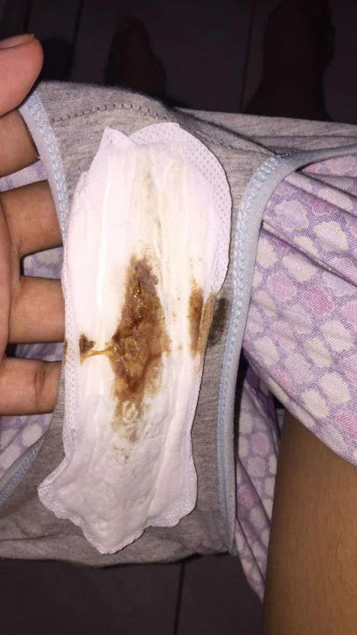 mucus plug napo ba to?