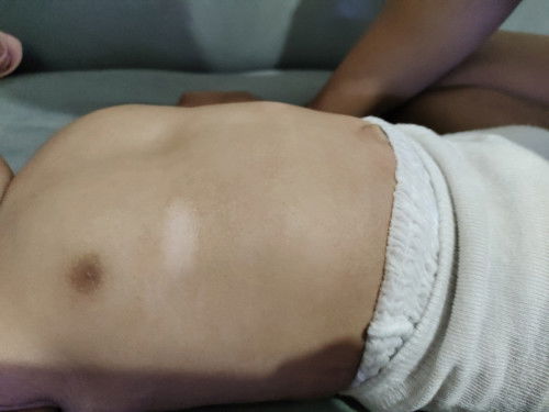 Bantu sharing barangkali ada yg ngalamin