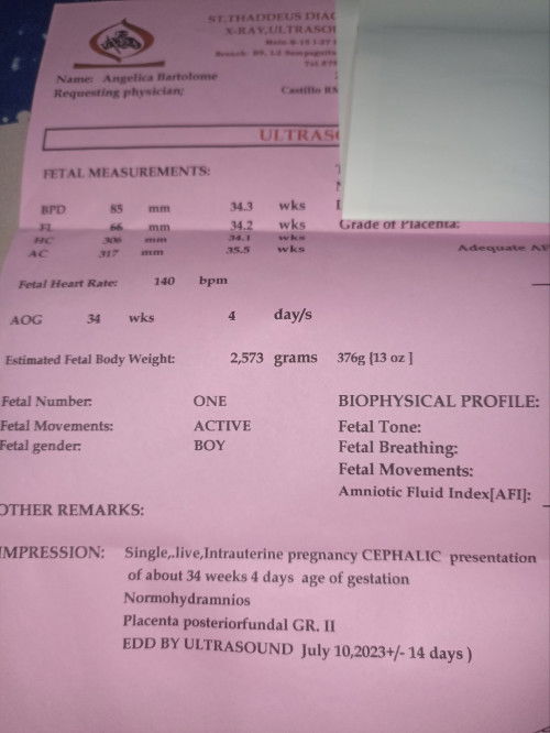 36weeks and 6days preggy