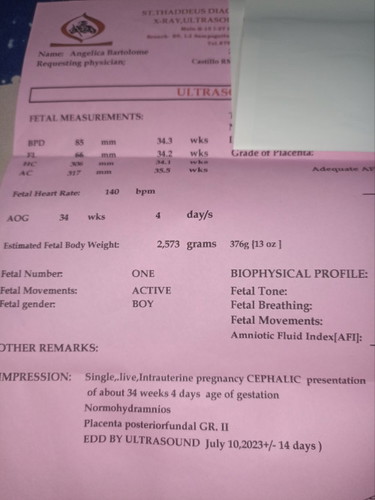 36weeks and 6days preggy